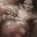 Syphon Flesh